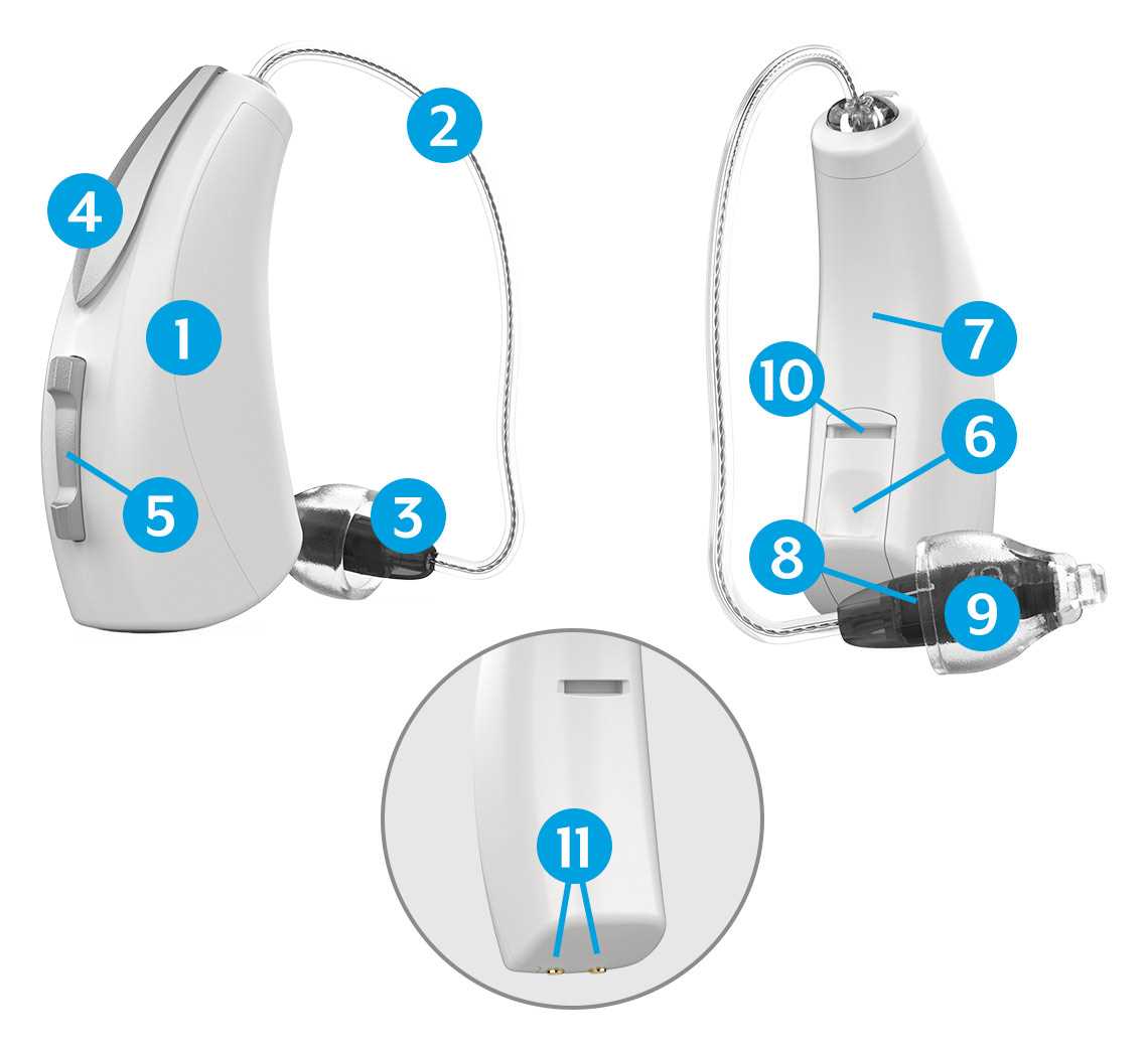 diagram hearing aid parts